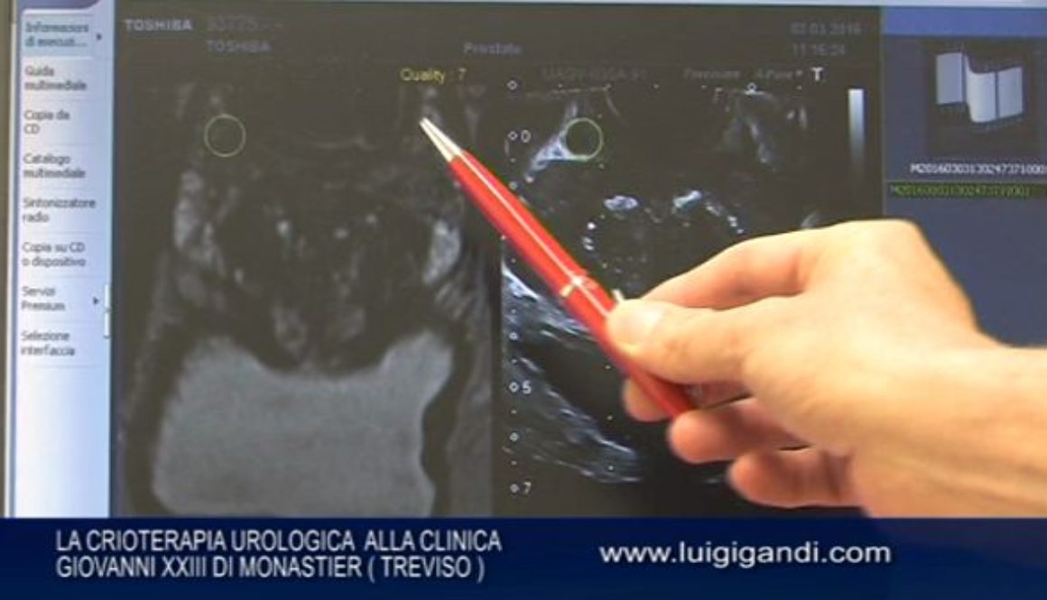 Clinica_Giovanni_XXIII_Dr_Morana-Urologia